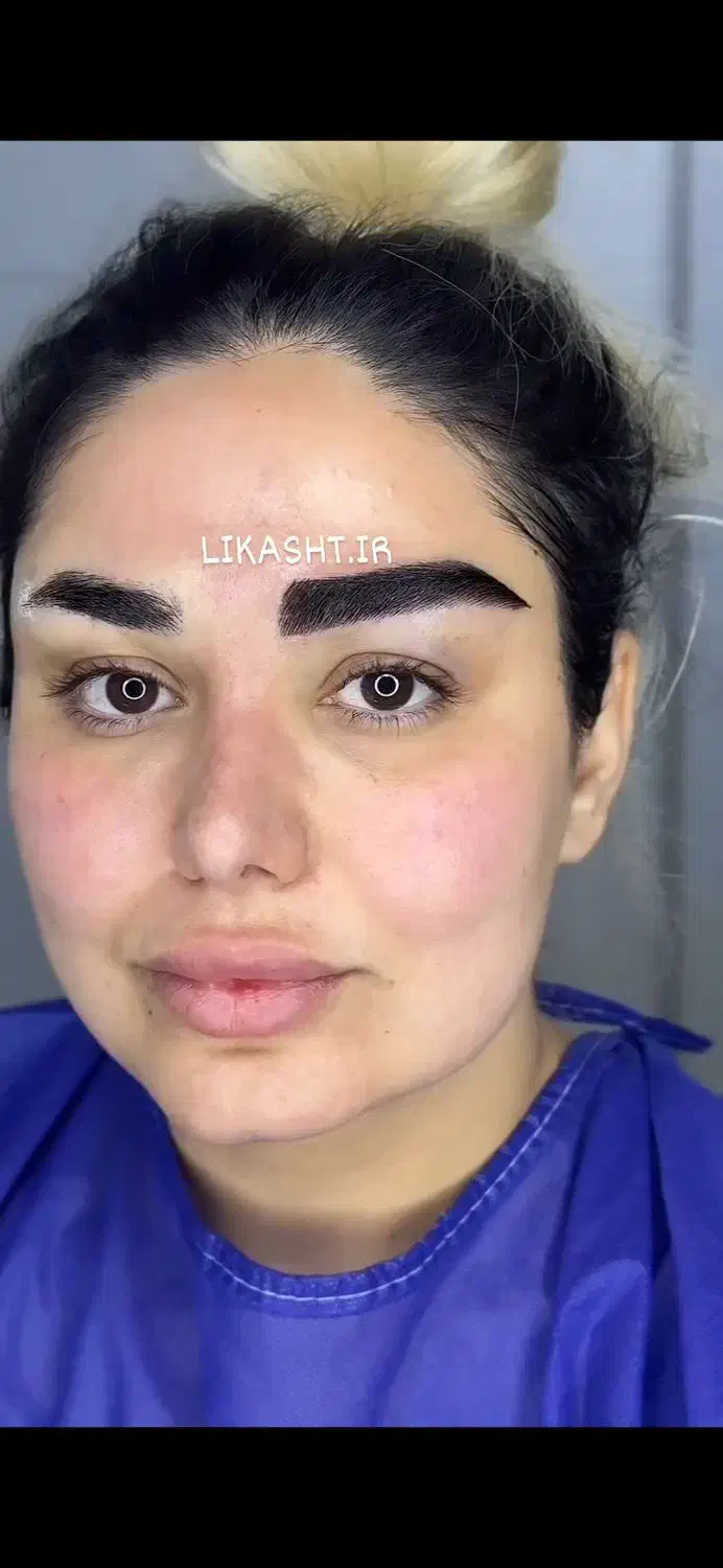 جشنواره طلایی کاشت ابرو سه بعدی کاشت مو (سوپر vip)|خدمات آرایشگری و زیبایی|تهران, سعادتآباد|دیوار