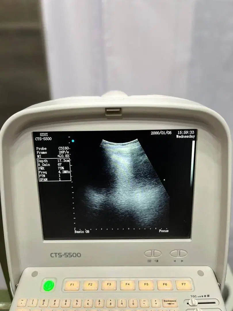 سونوگرافی siui|پزشکی|تهران, جمهوری|دیوار