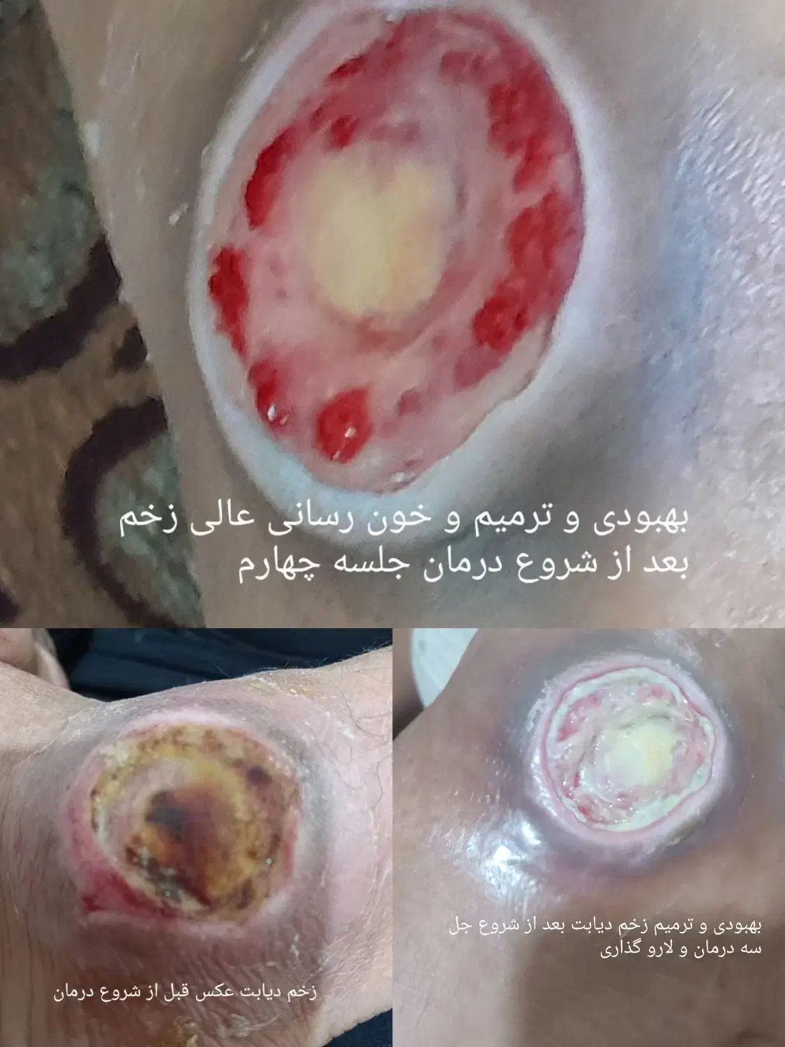 بخیه و تزریقات و پانسمان پیشرفته|خدمات آرایشگری و زیبایی|اهواز, منازل کارون|دیوار