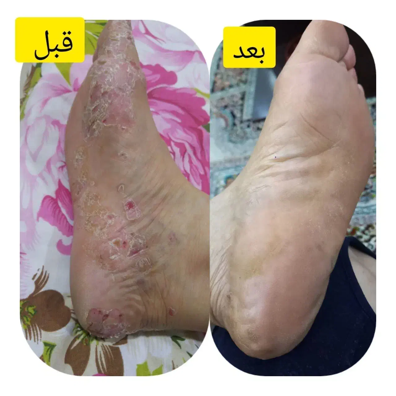 درمان از دل طبیعت|آرایشی، بهداشتی، درمانی|حمیدیه, |دیوار