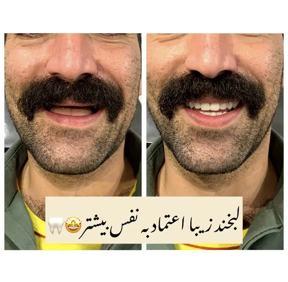 دندانسازی نیکو|خدمات آرایشگری و زیبایی|الوند, |دیوار