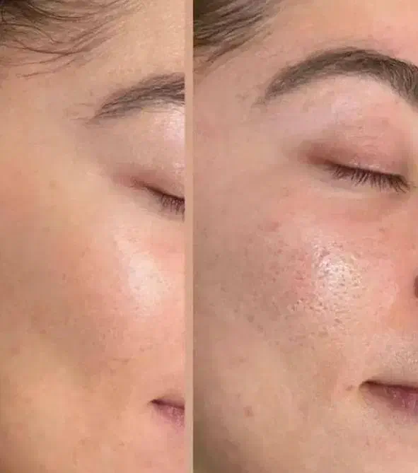 مراقبت پوست و مو|آرایشی، بهداشتی، درمانی|شیراز, طلاب|دیوار