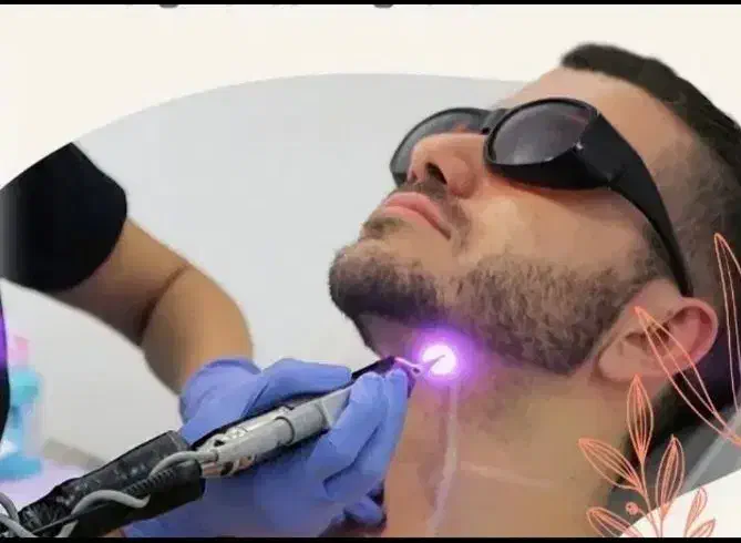 جشنواریلدا لیزر/فقط199ت/تا5شنبه/فقط در3جلسه/تضمینی|خدمات آرایشگری و زیبایی|اصفهان, باغ زیار|دیوار