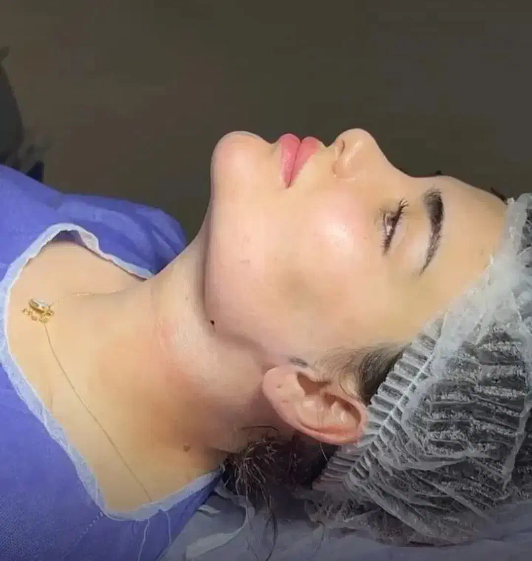 جراحی پلک غبغب صورت نخ آنزیم فیلر مزو ژل بوتاکس|خدمات آرایشگری و زیبایی|کرج, گوهردشت|دیوار