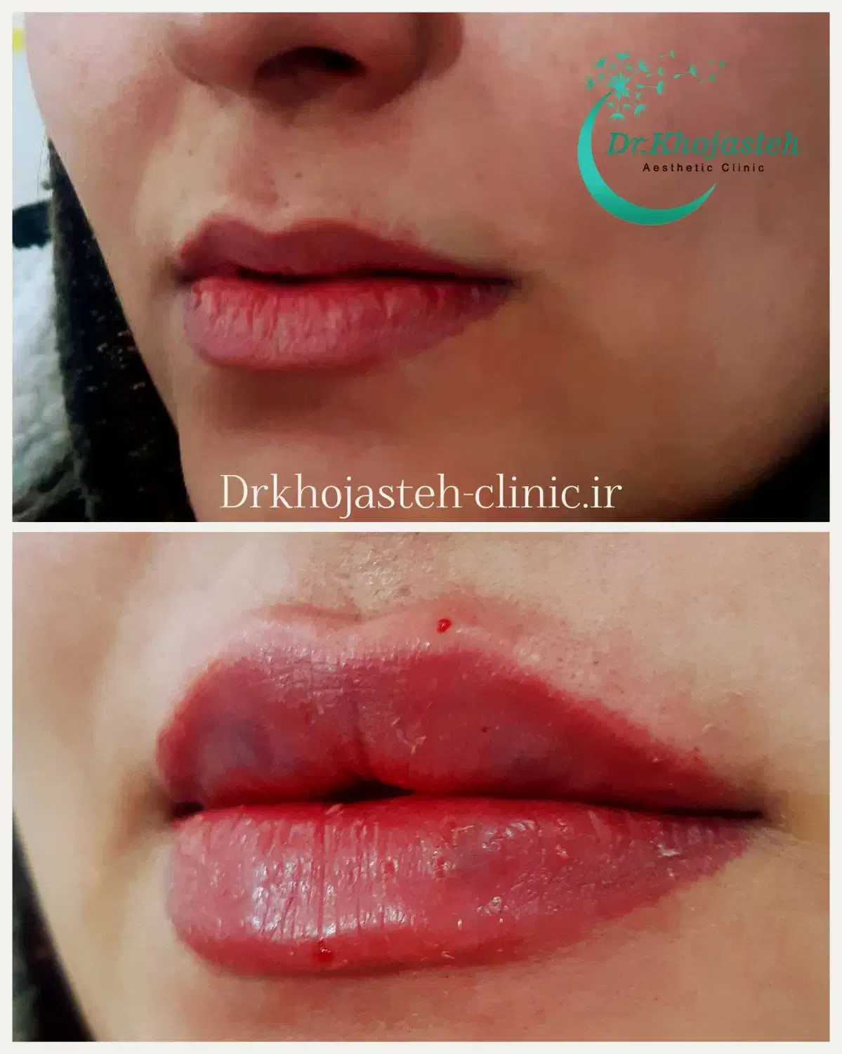 خدمات زیبایی برای زیباجویان عزیز|خدمات آرایشگری و زیبایی|چناران, |دیوار