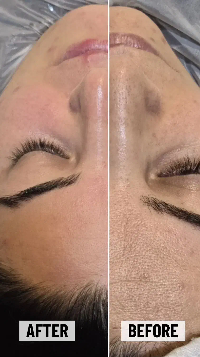 آموزش تخصصی فیشال و پاکسازی پوست|خدمات آموزشی|ارومیه, |دیوار