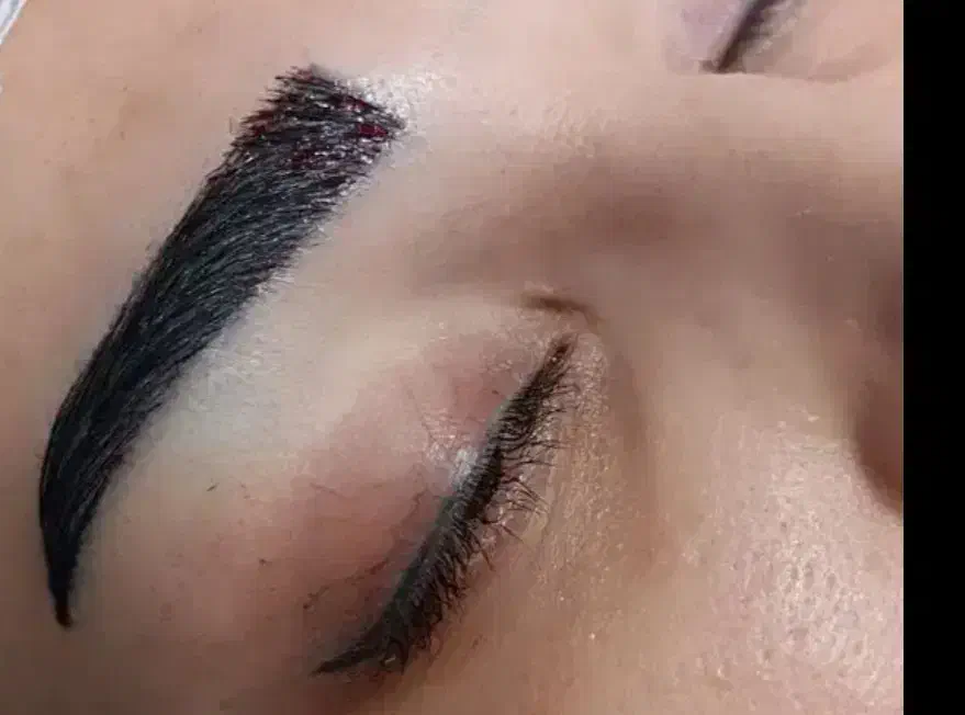 / کاشت مو و ابرو /بلفارو/ /عمل بینی ژل وبوتاکس|خدمات آرایشگری و زیبایی|تهران, دکتر هوشیار|دیوار