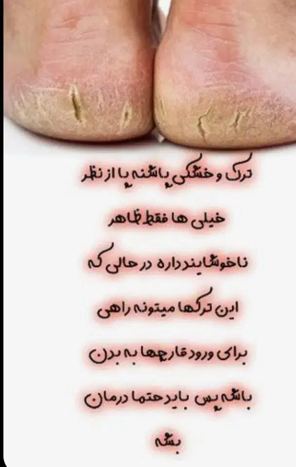 تخفیف ویژه روز مادرو یلدا فشیال دست وپاو صورت|خدمات آرایشگری و زیبایی|اصفهان, گرکان|دیوار