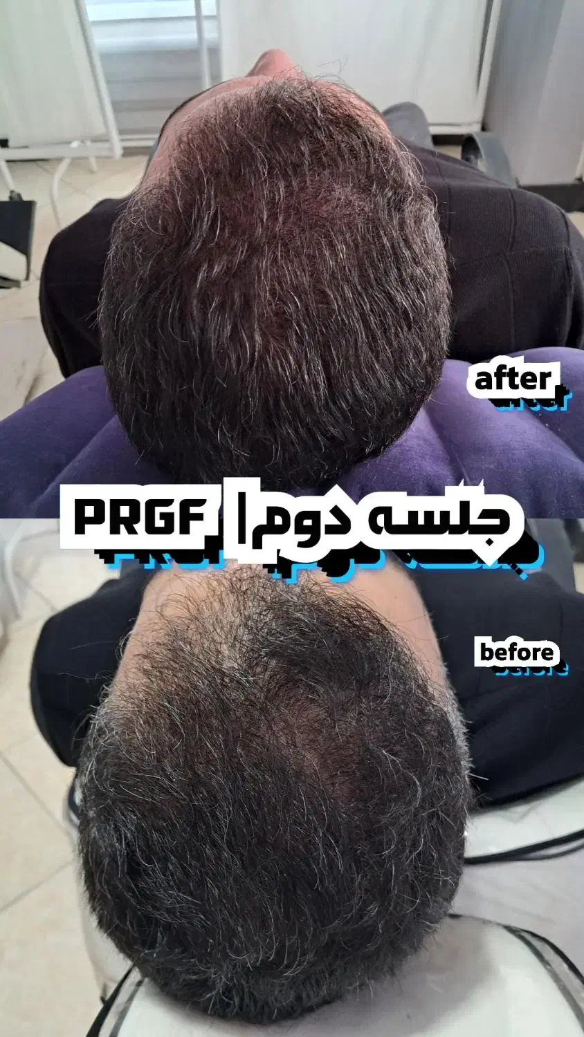 مرکز پی آر پی ،مزوتراپی ،سلول درمانی ،زانو،بوتاکس|خدمات آرایشگری و زیبایی|کرج, عظیمیه|دیوار