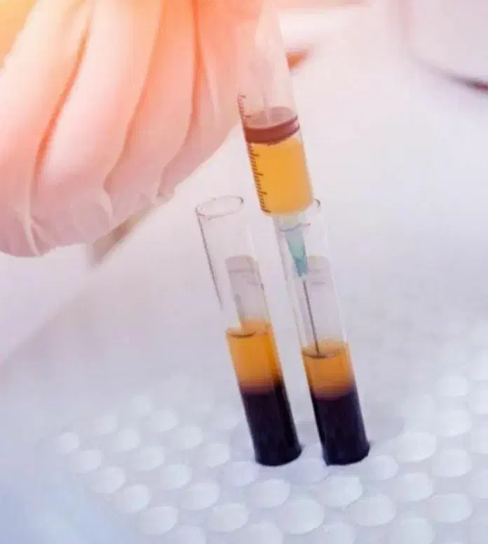 جشنواره prp و مزوتراپی ( آقایان و بانوان)|خدمات آرایشگری و زیبایی|بروجرد, |دیوار