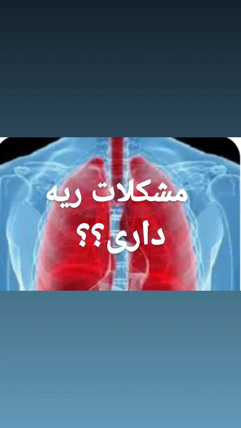 ریه هاتو آیینه کن|آرایشی، بهداشتی، درمانی|گنبد کاووس, |دیوار