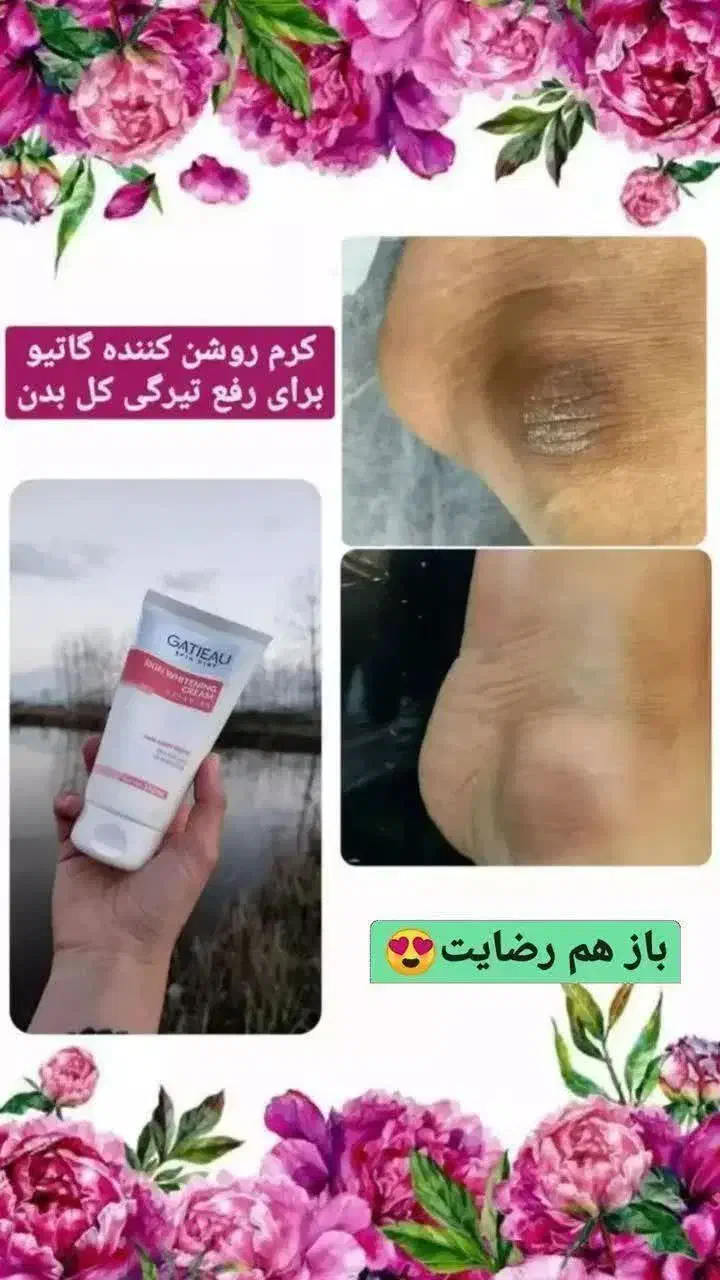 محصول ارایشی و زیبایی|آرایشی، بهداشتی، درمانی|مهاباد (آذربایجان غربی), |دیوار