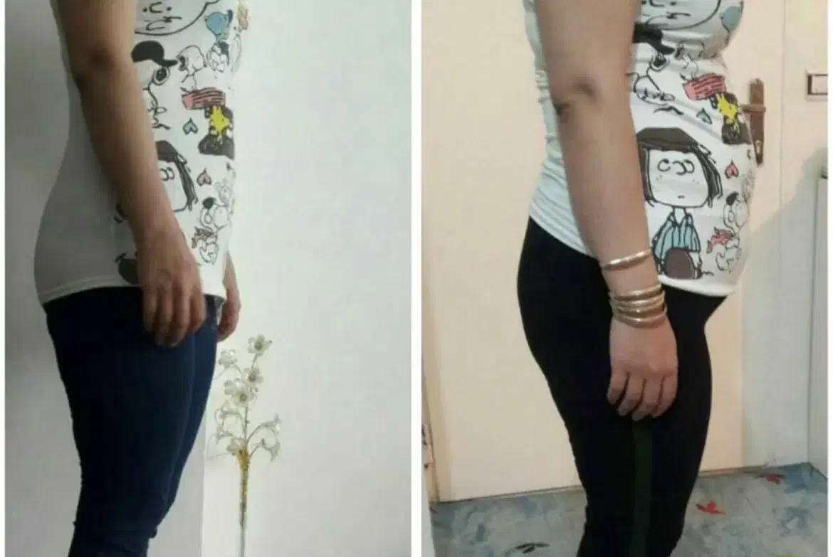 لاغری موضعی بادستگاه،مزوتراپی چربی سوز،رژیم درمانی|خدمات آرایشگری و زیبایی|زنجان, |دیوار