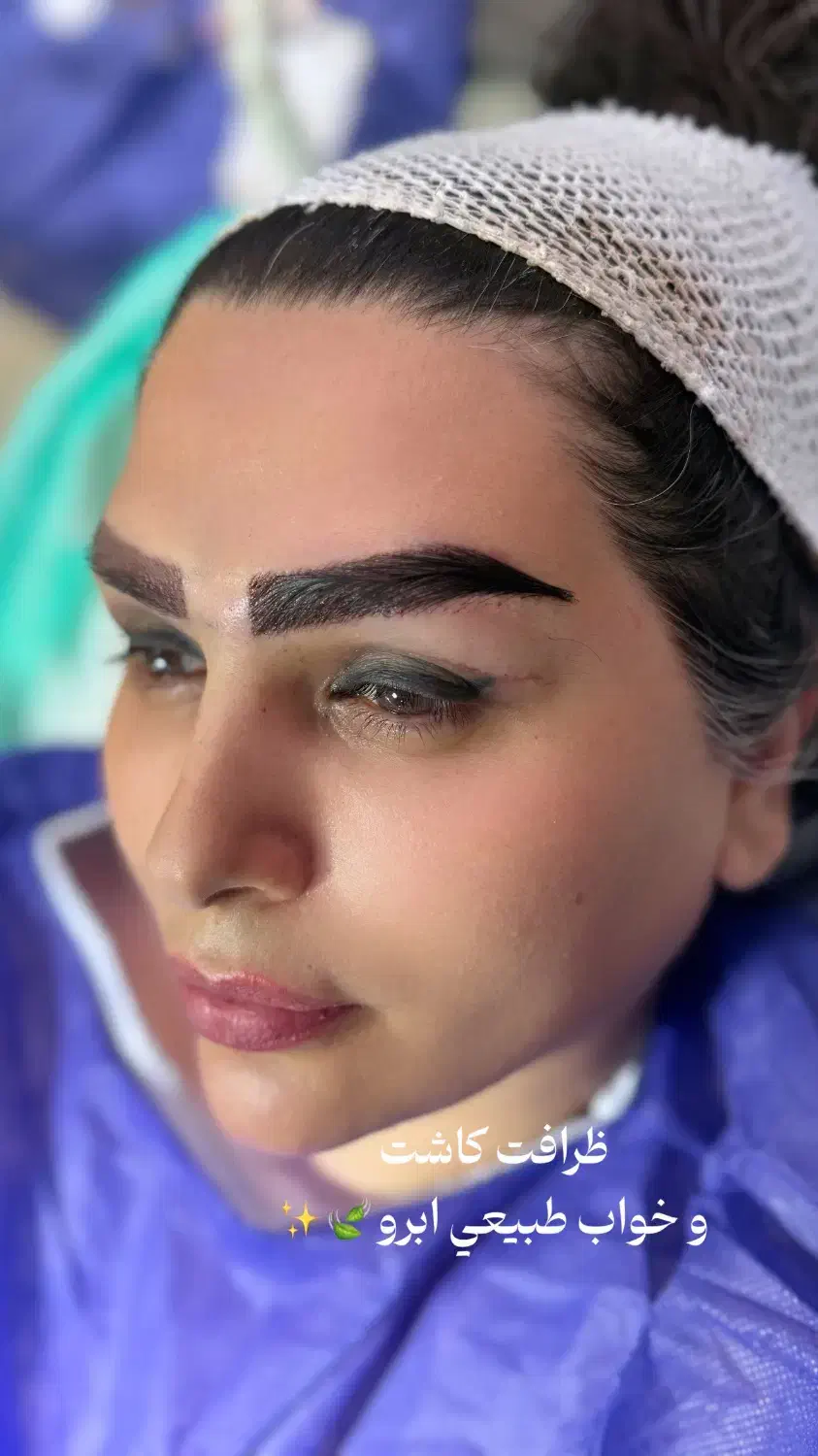 تخفیف میکروکاشت با و بدون جراحی نقد و اقساط|خدمات آرایشگری و زیبایی|بوشهر, |دیوار