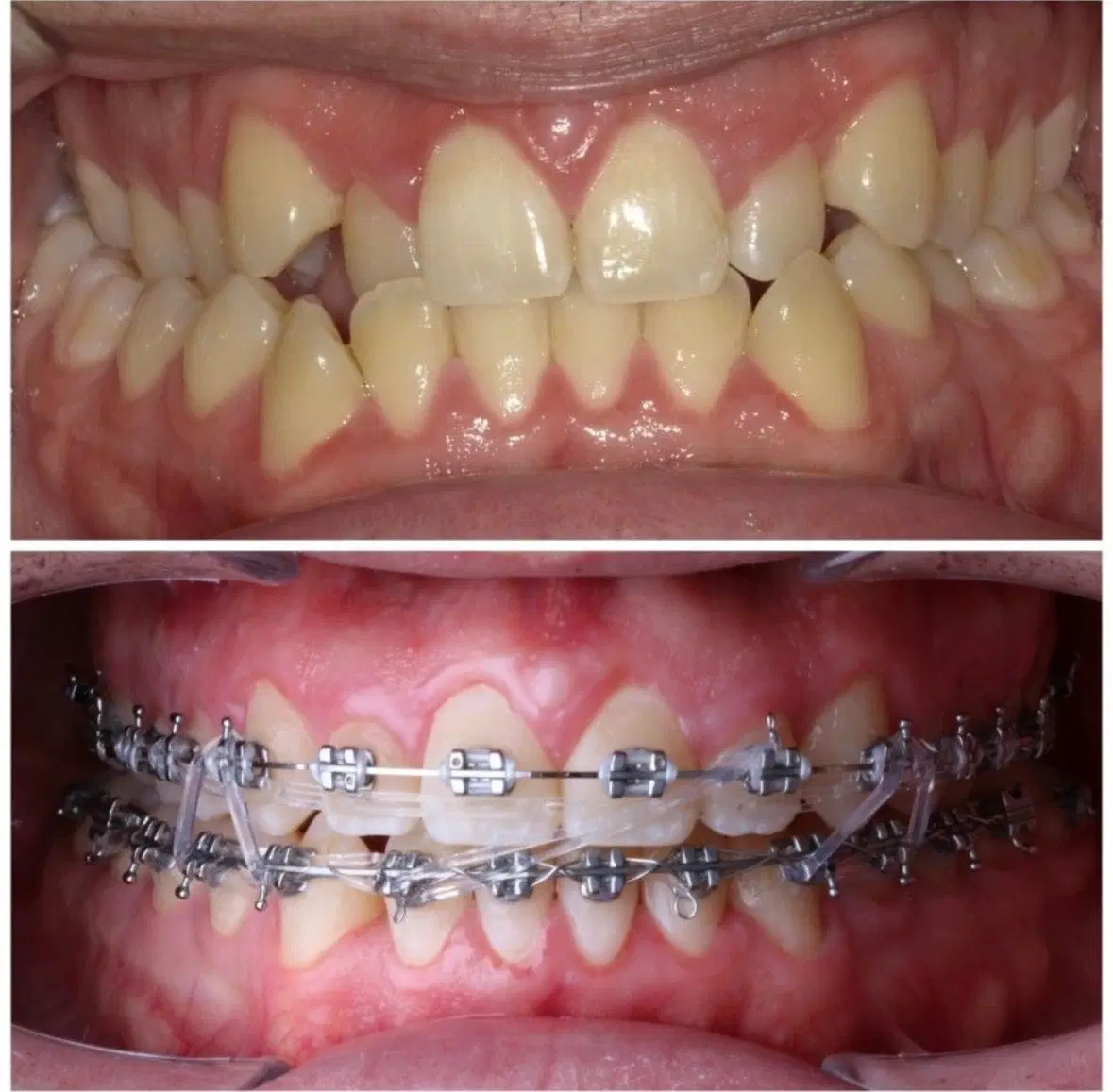 جشنواره ویژه دندانپزشکی و ارتودنسی توسط متخصص|خدمات زیبایی و سلامت|تبریز, |دیوار