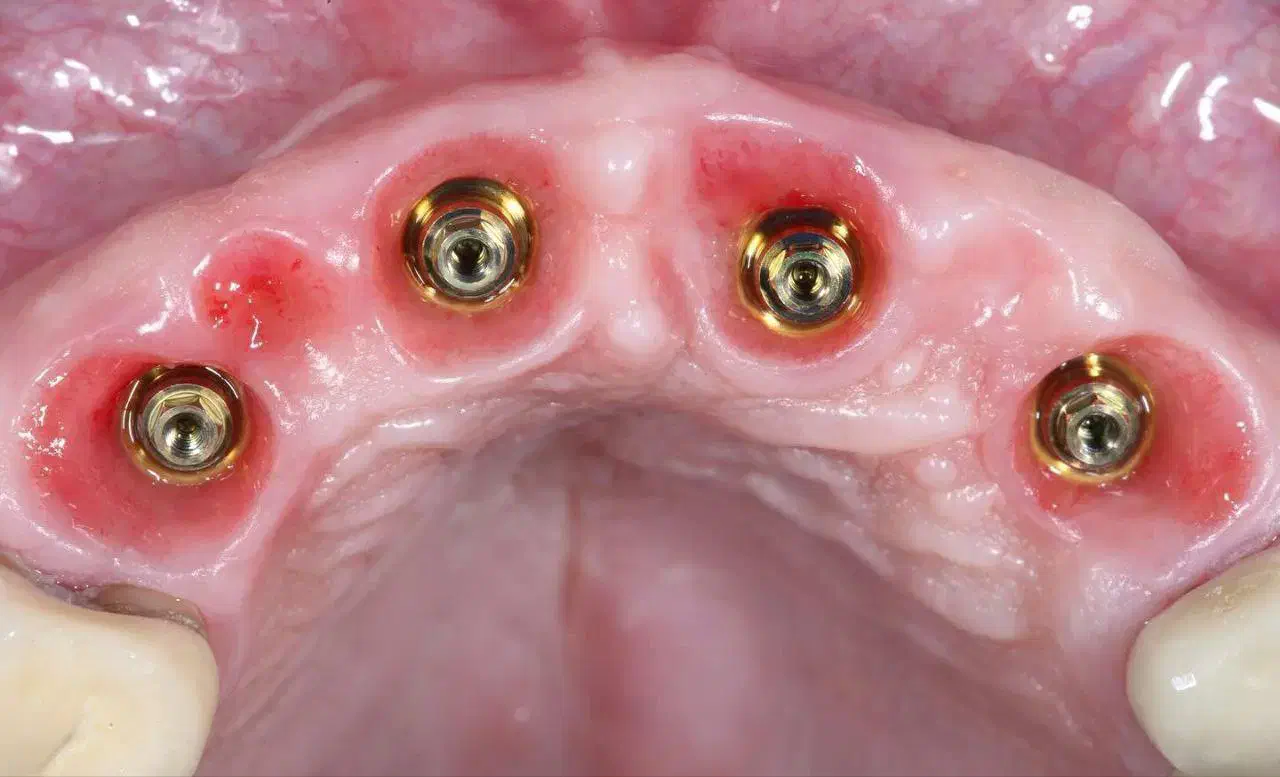 اوردنچر دوفک فقط ۱۰۰ تومن در تبریز|خدمات آرایشگری و زیبایی|مشگین شهر, |دیوار