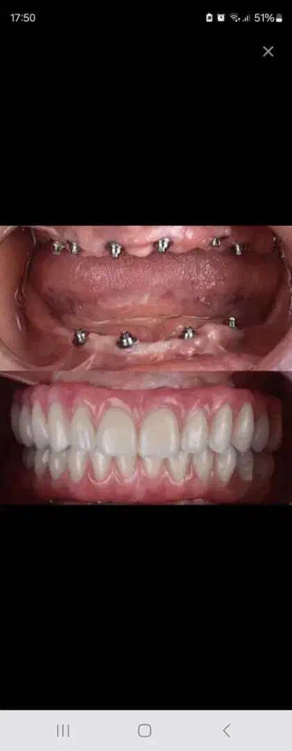 مرکز تخصصی ایمپلنت دیجیتال..|خدمات آرایشگری و زیبایی|تهران, زعفرانیه|دیوار