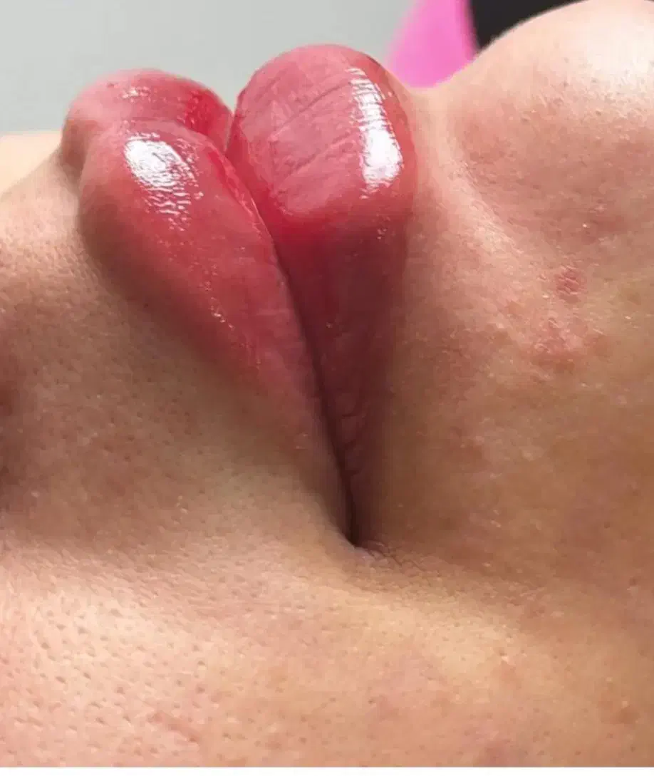 تزریقات تخصصی ژل و بوتاکس|خدمات آرایشگری و زیبایی|اهواز, شهرک دانشگاه|دیوار