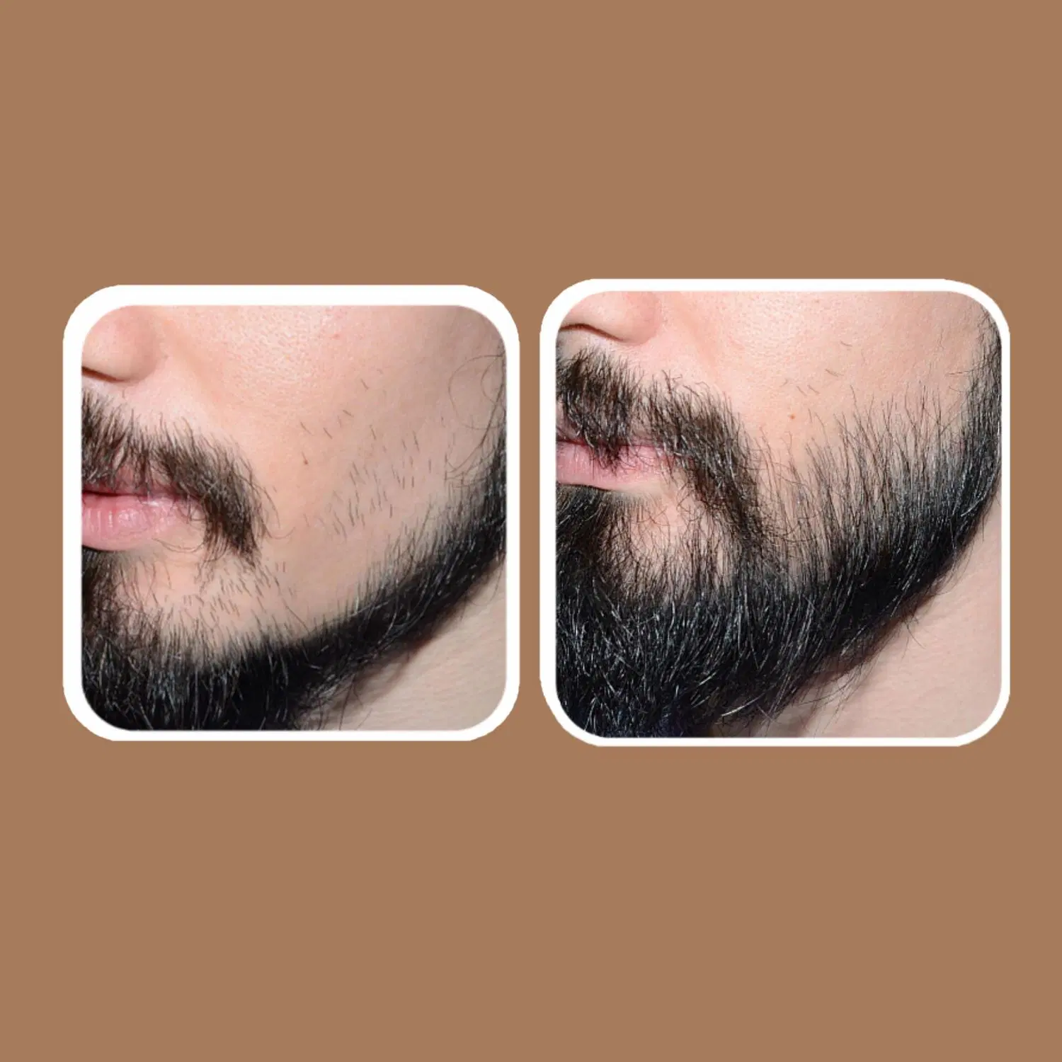 رویش مجدد|آرایشی، بهداشتی، درمانی|فارسان, |دیوار