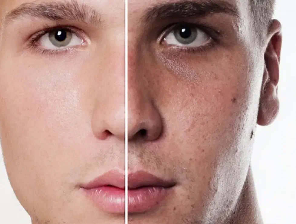 ۲۵٪تخفیف یلدایی پاکسازی پوست صورت اقایان حرفه ایی|خدمات آرایشگری و زیبایی|ایلام, |دیوار