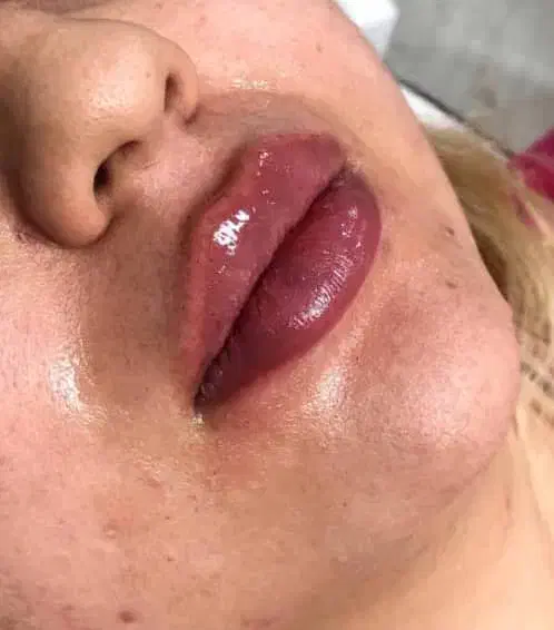 تزریق ژل و بوتاکس و کاشت نخ و مزوژل های جوان ساز|خدمات آرایشگری و زیبایی|شیراز, ابیوردی|دیوار