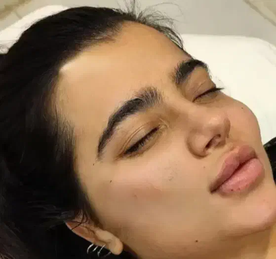 جشنواره پاییزه زیبایی ژل بوتاکس لیزر مزو|خدمات آرایشگری و زیبایی|رشت, نامجو|دیوار