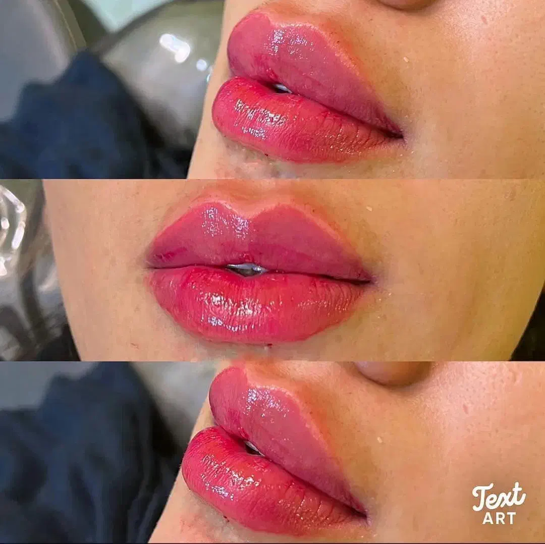 مادلینگ صورت( ژل و بوتاکس)|خدمات آرایشگری و زیبایی|زرقان, |دیوار