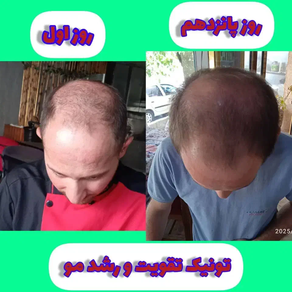 تونیک تقویت کننده مو رشد مجدد|آرایشی، بهداشتی، درمانی|تربتحیدریه, ۴۵ متری|دیوار