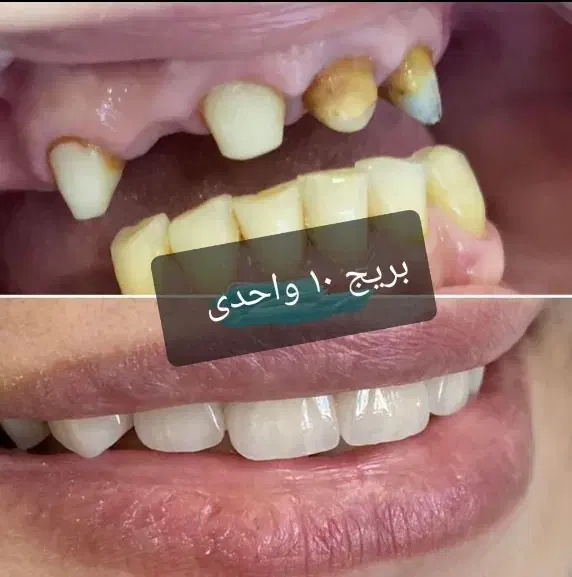 دندانسازی ناب نصف قیمت بازار|پزشکی|شیراز, حجت آباد|دیوار