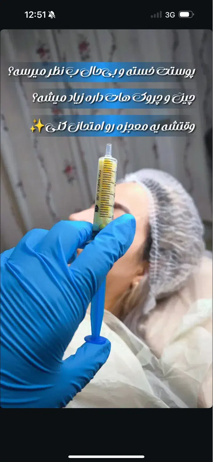 خداحافظی با ریزش مو و ابرو|خدمات آرایشگری و زیبایی|شیراز, قصرالدشت|دیوار
