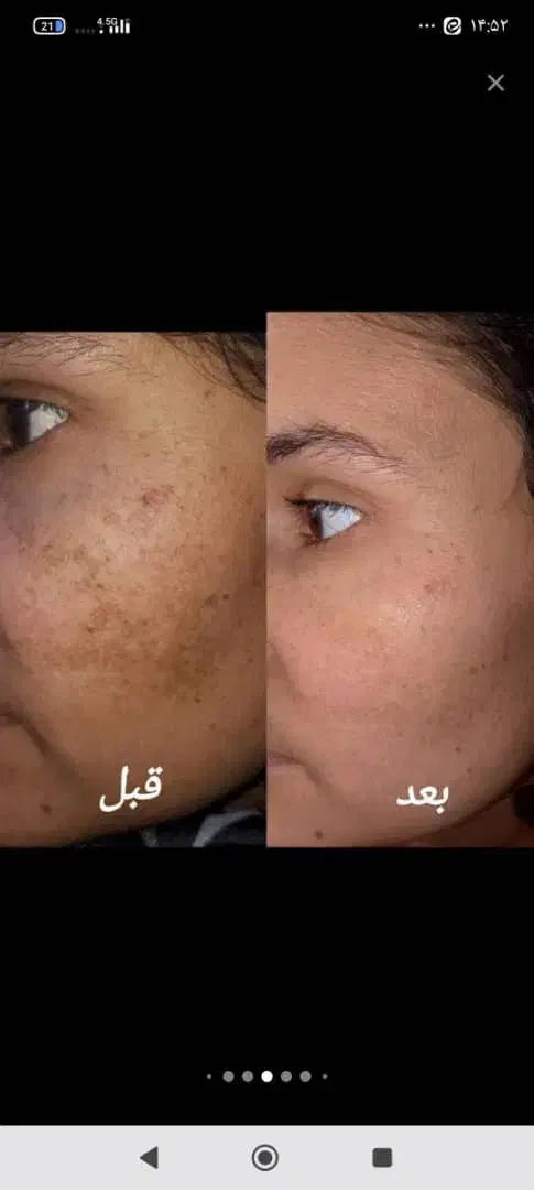 آرایش|خدمات آرایشگری و زیبایی|قرچک, مهدیه|دیوار