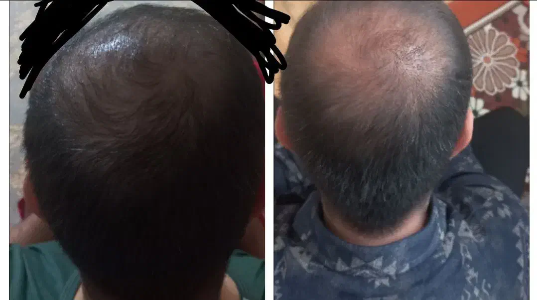 تونیک تقویت کننده مو|آرایشی، بهداشتی، درمانی|خرمآباد, |دیوار