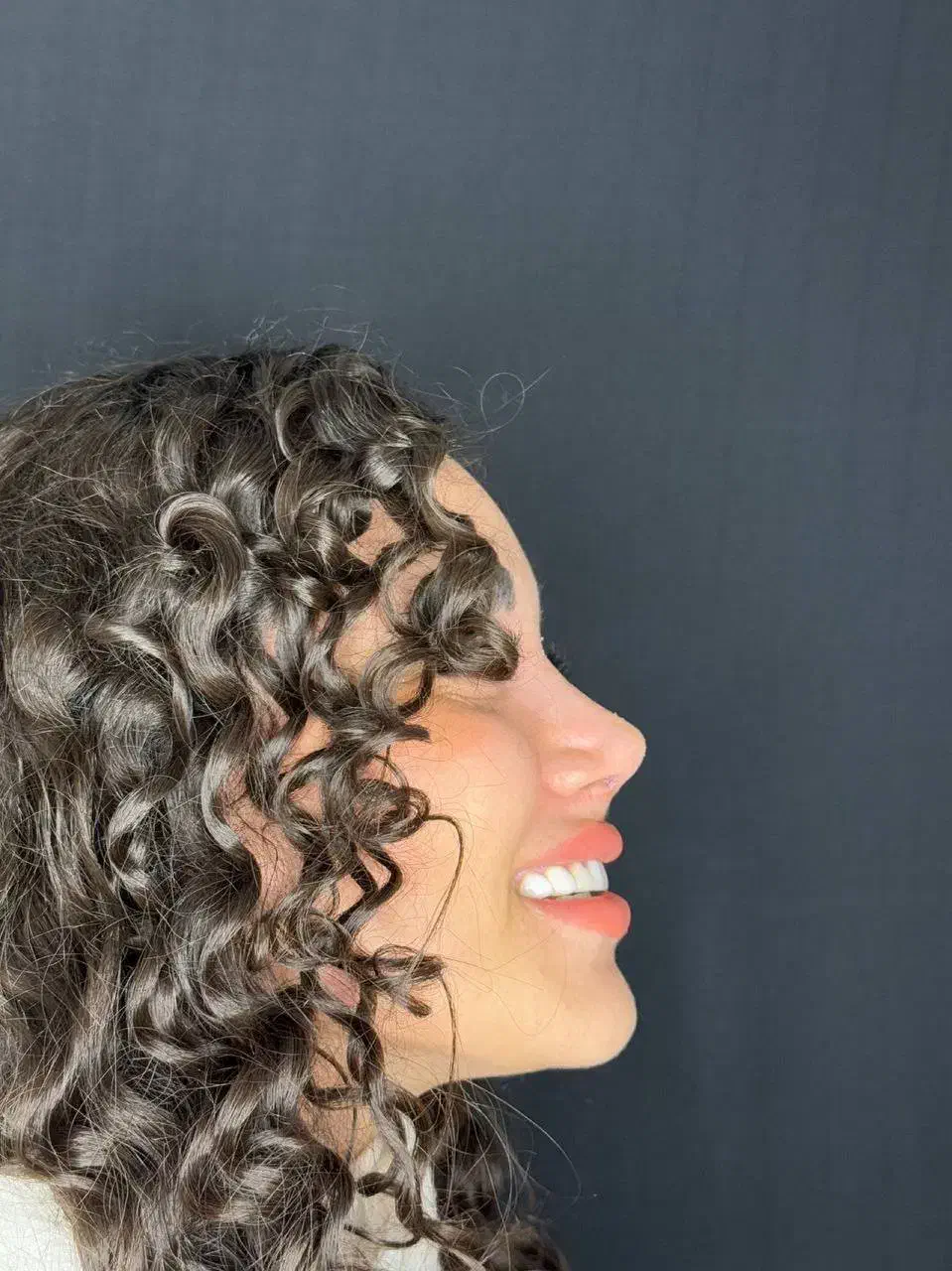 50%تخفیف ویژه عمل جراحی بینی بدون تامپون لیفت|خدمات آرایشگری و زیبایی|فردیس, طالقانی|دیوار