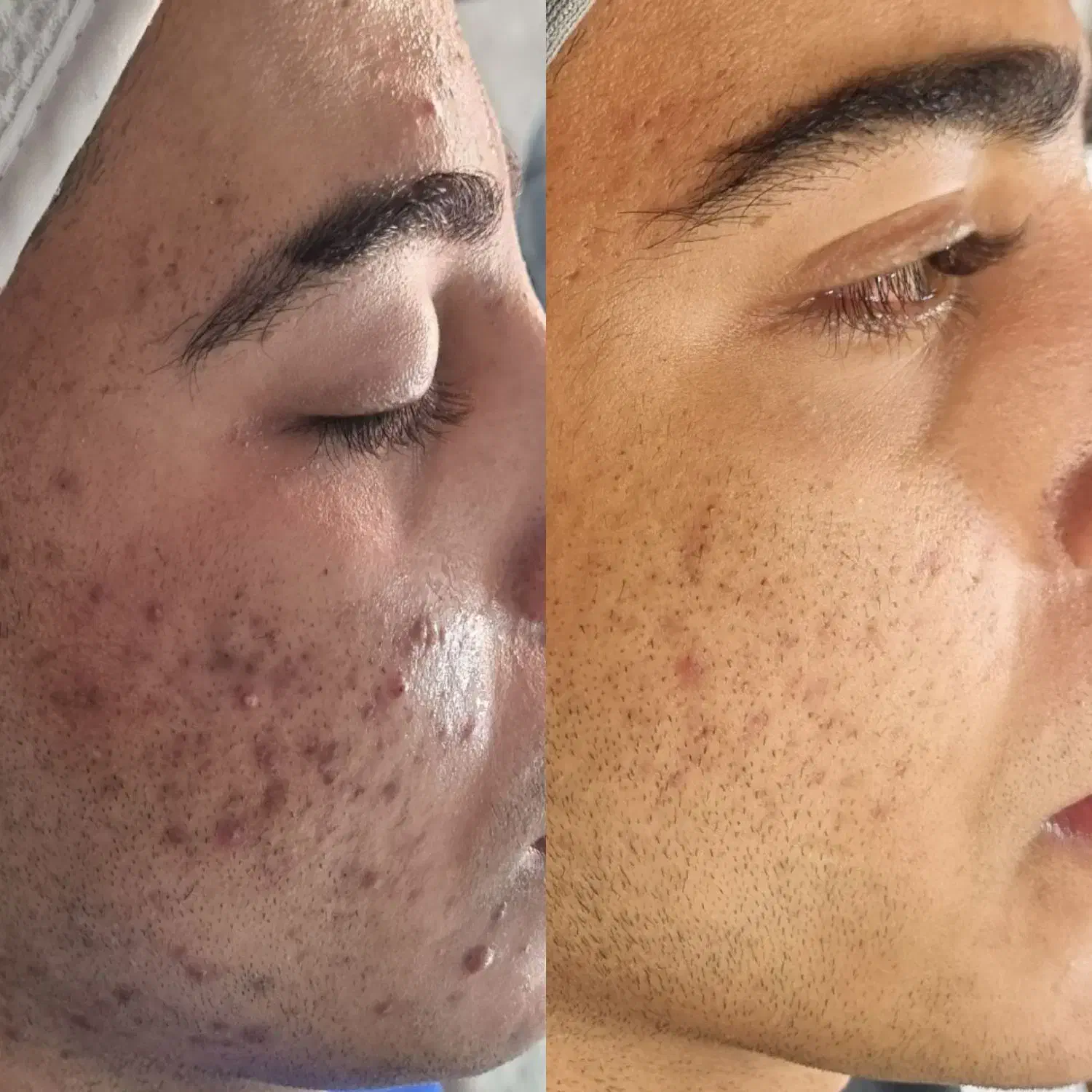 پاکسازی وفشیال تخصص آقا و خانم|خدمات آرایشگری و زیبایی|قم, بلوار امین و ساحلی|دیوار