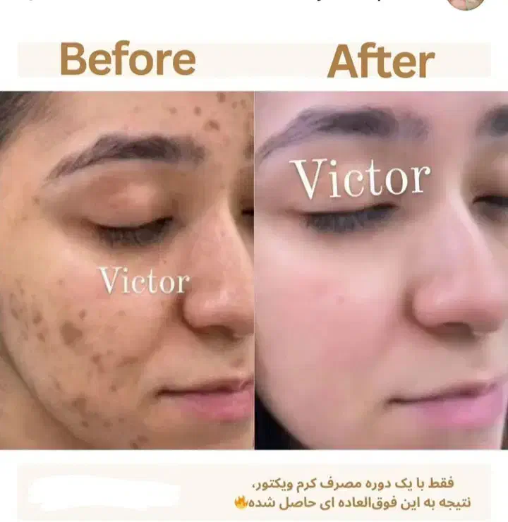 کرم فوقالعاده قوی ویکتور قیمت یک میلیون .|حراج|بروجرد, |دیوار