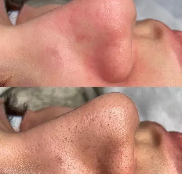 جشنواره پاکسازی پوست|خدمات آرایشگری و زیبایی|اصفهان, چرخاب|دیوار