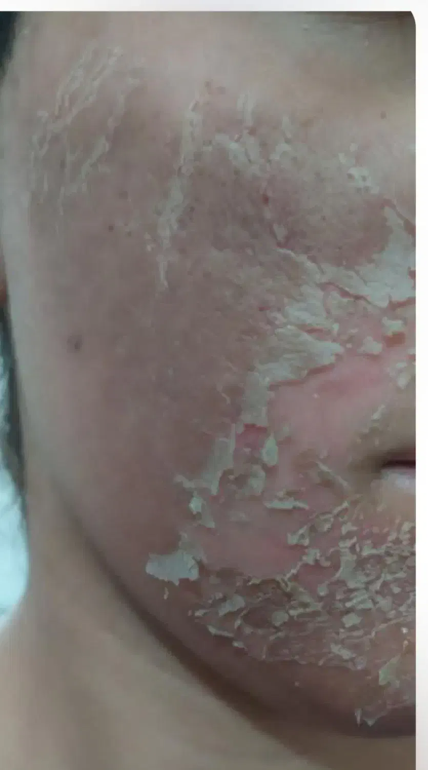 پاکسازی صورت مطب دکتر آذین اسکندری|خدمات آرایشگری و زیبایی|دوگنبدان, |دیوار