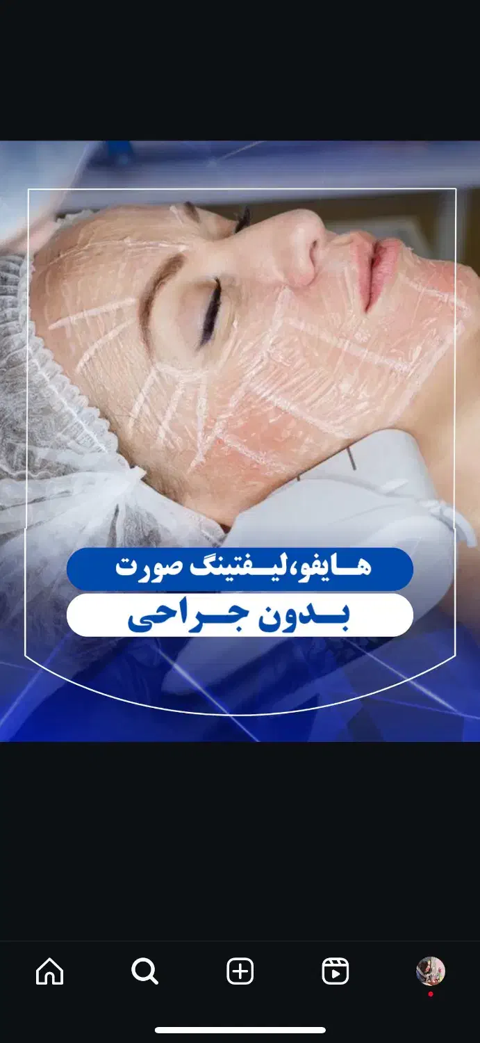 هایفوتراپی صورت. رفع غبغب. لاغری با قیمت ۲۵۰۰|خدمات آرایشگری و زیبایی|شاهین‌شهر, خانه کارگر|دیوار