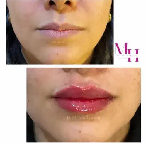 دستیار پزشک زیبایی|استخدام درمانی، زیبایی، بهداشتی|قم, صدوق|دیوار