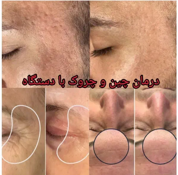 انجام خدمات پوستی هم بانوان و اقایان|خدمات آرایشگری و زیبایی|گرگان, |دیوار