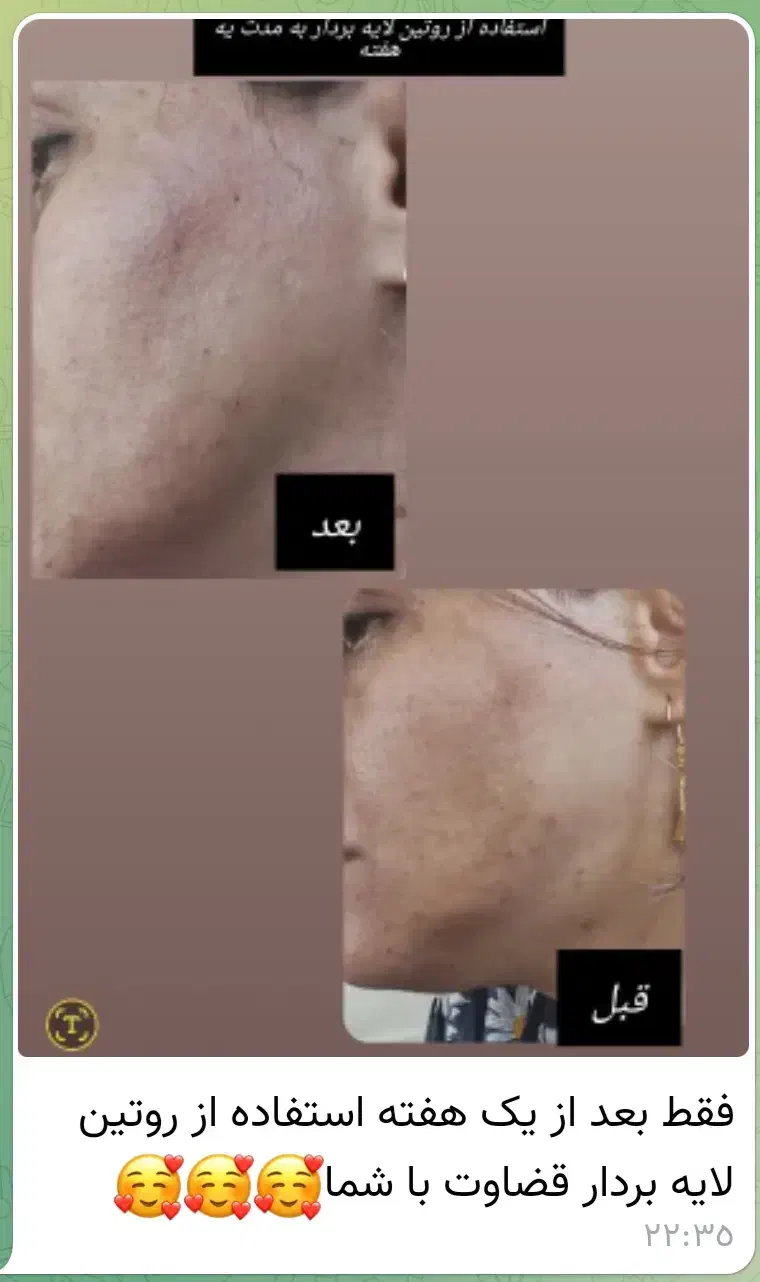 سارا محمدپور هستم|آرایشی، بهداشتی، درمانی|تهران, آزادشهر|دیوار