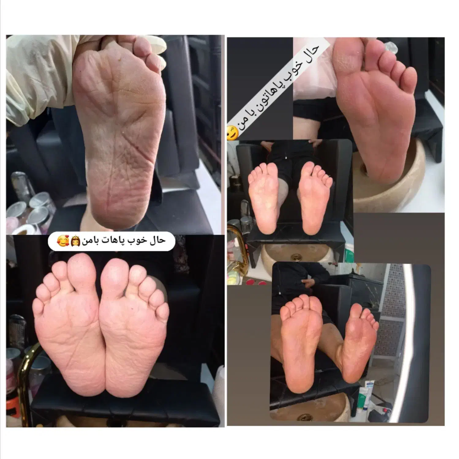 جشنواره پر تخفیف پدیکور|خدمات آرایشگری و زیبایی|مشهد, هفت تیر (آب و برق)|دیوار