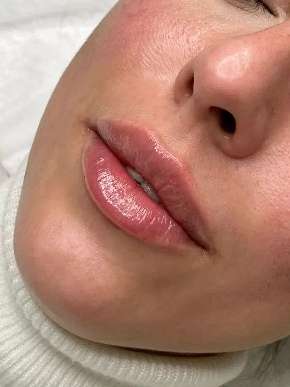 تخفیف ژل لب و بوتاکس فیلر مزو دکتر کاظمی|خدمات آرایشگری و زیبایی|مشهد, کوثر|دیوار