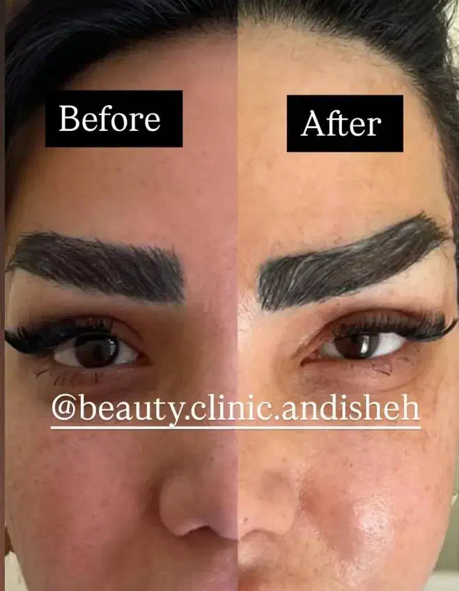 جراحی زیبایی بلفاروپلاستی،مینی لیفت صورت|خدمات آرایشگری و زیبایی|اندیشه, اندیشه فاز ۱|دیوار