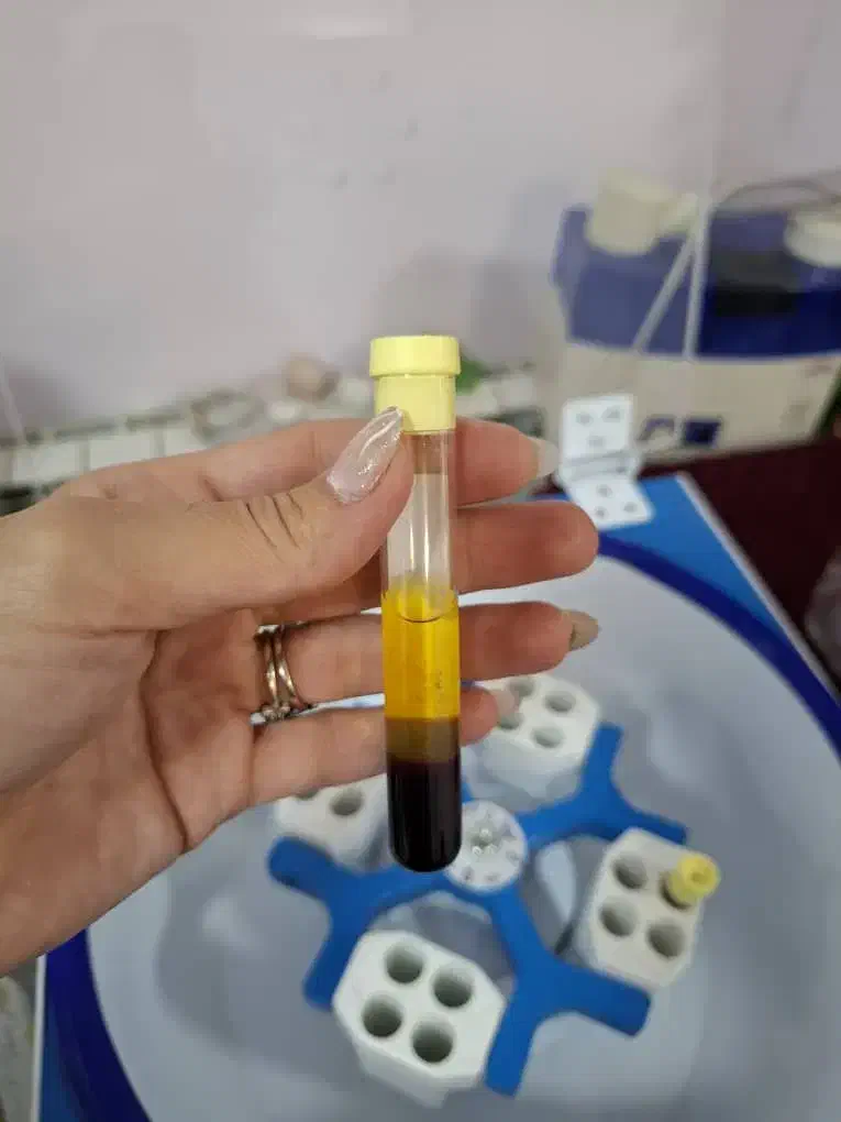 درمان ریزش مو|آرایشی، بهداشتی، درمانی|خوی, |دیوار