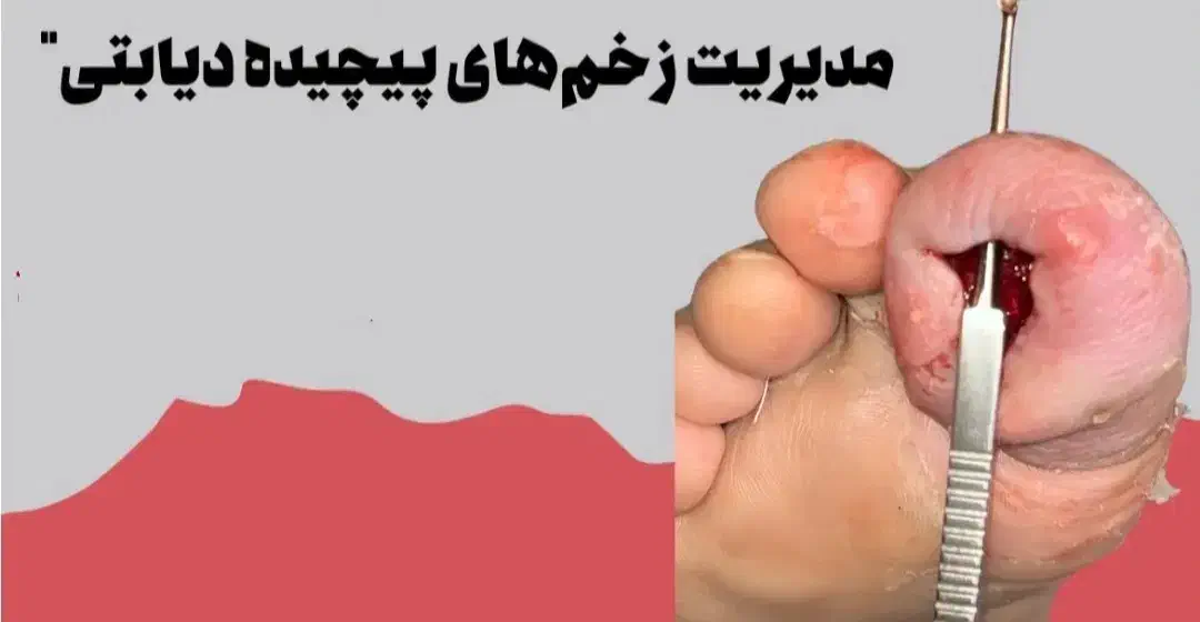 درمانگر زخم|خدمات آرایشگری و زیبایی|سیرجان, |دیوار