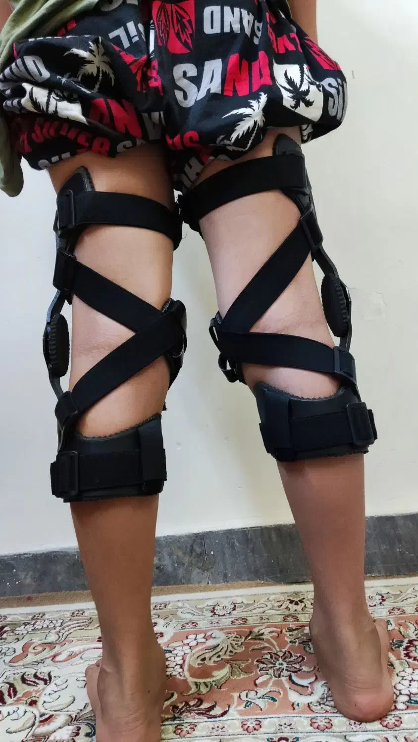 زانوبند طبی|آرایشی، بهداشتی، درمانی|کرج, شهرک اوج|دیوار