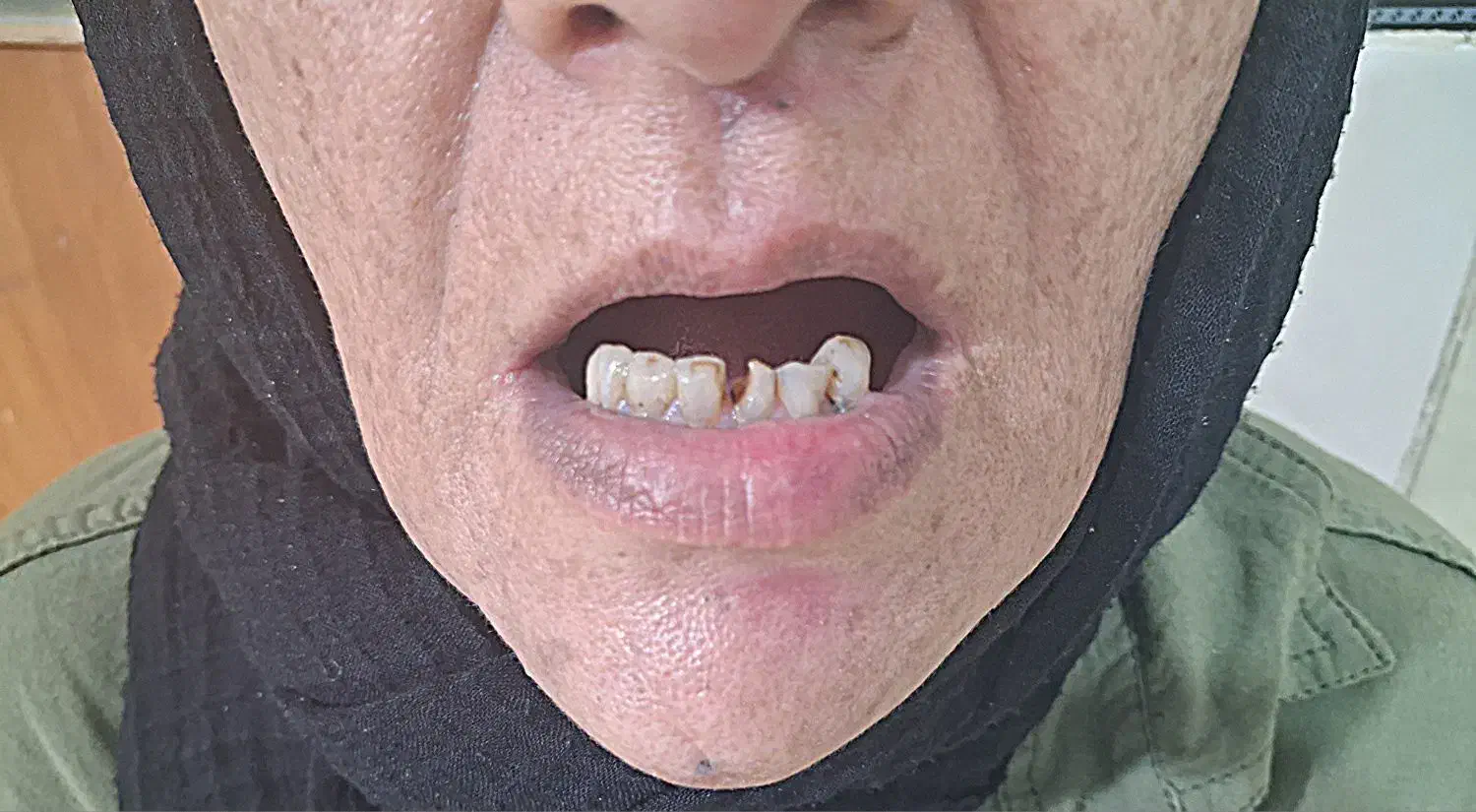 ساخت دندان|خدمات آرایشگری و زیبایی|خرمدره, |دیوار