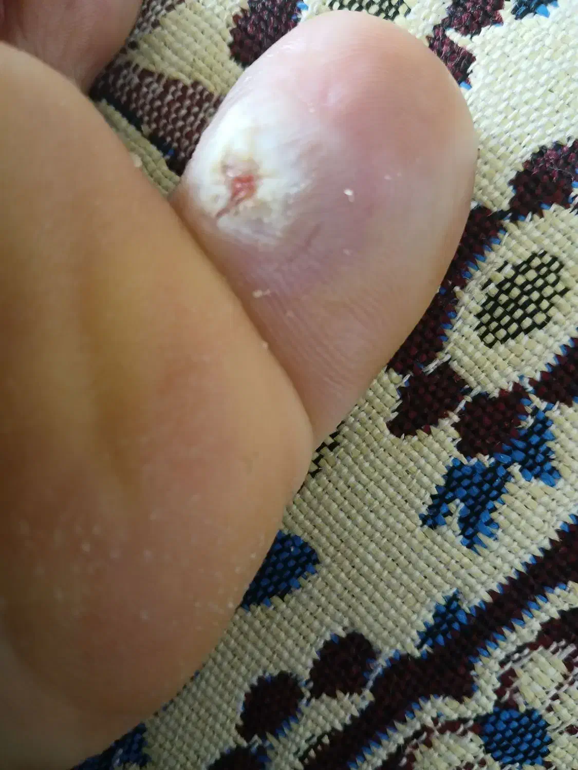 برداشتن خال زیگیل ومیخچه دست پابامحلول گیاهی|خدمات آرایشگری و زیبایی|نیشابور, بنیاد شهید|دیوار