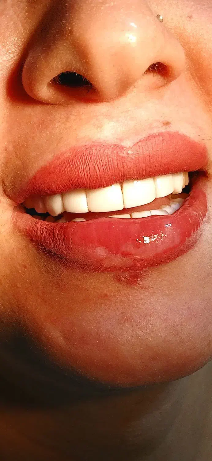 خدمات دندانپزشکی|خدمات آرایشگری و زیبایی|پارسآباد, |دیوار